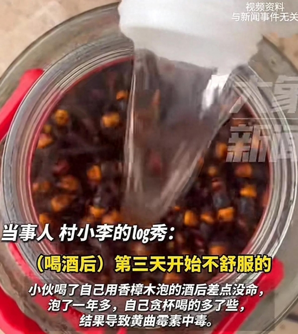 男子喝自泡药酒后黄曲霉素中毒ICU抢救两天半瘦成皮包骨(图1)